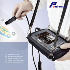 Krankenhaus-Handheld-Ultraschallscanner (wwwb4000)