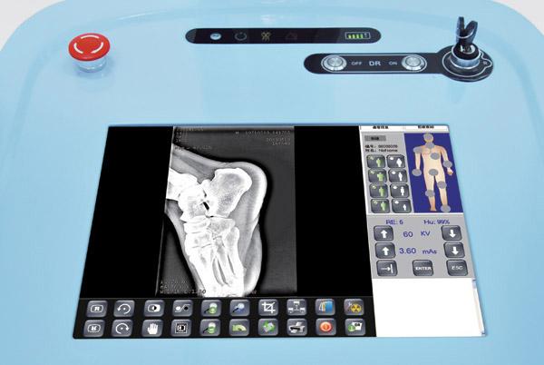Hosipital Hochfrequenz mobiles digitales Radiographiesystem