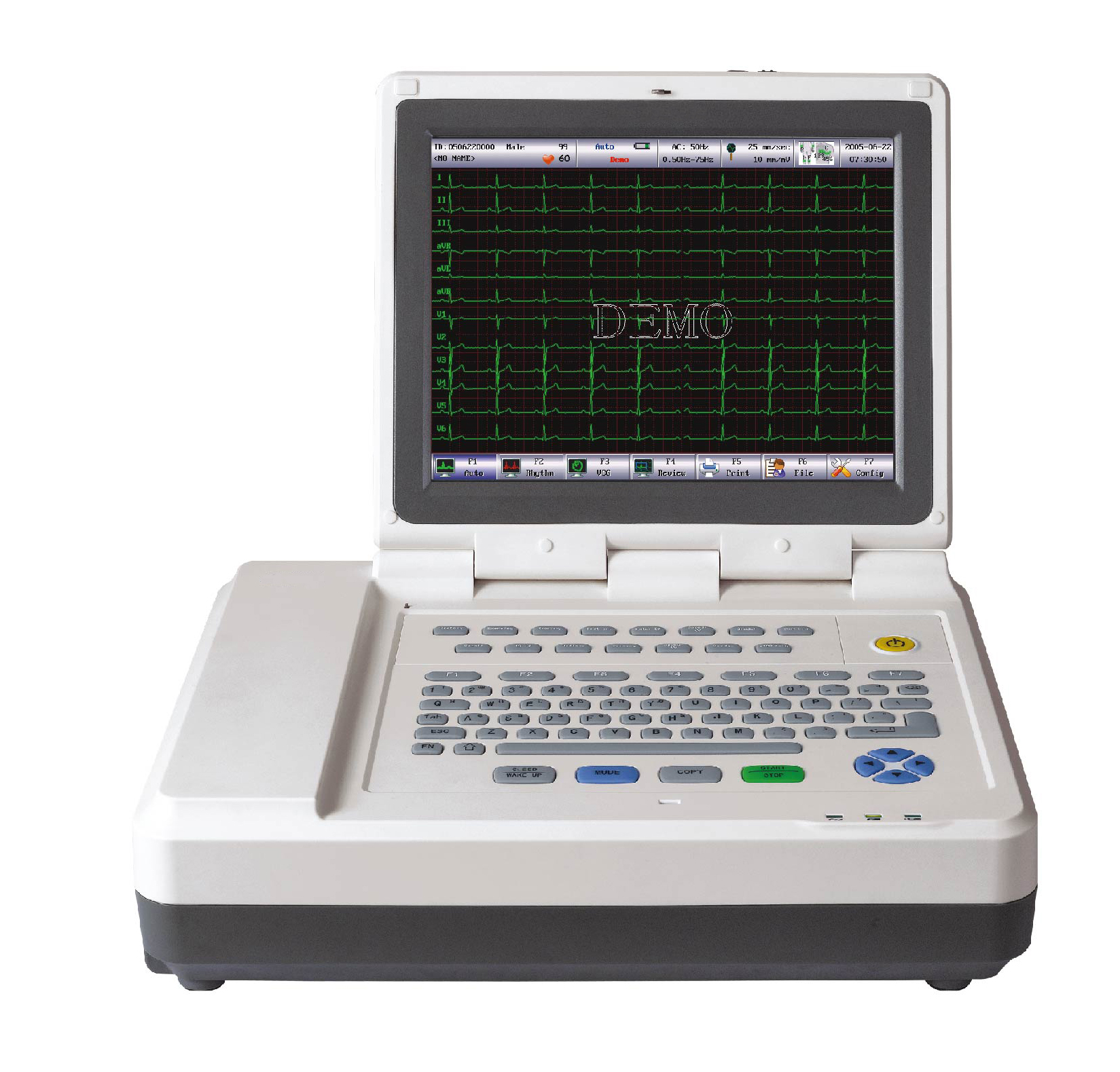China 12 Zwölfkanal EKG EKG Elektrokardiograph Maschinenlieferanten