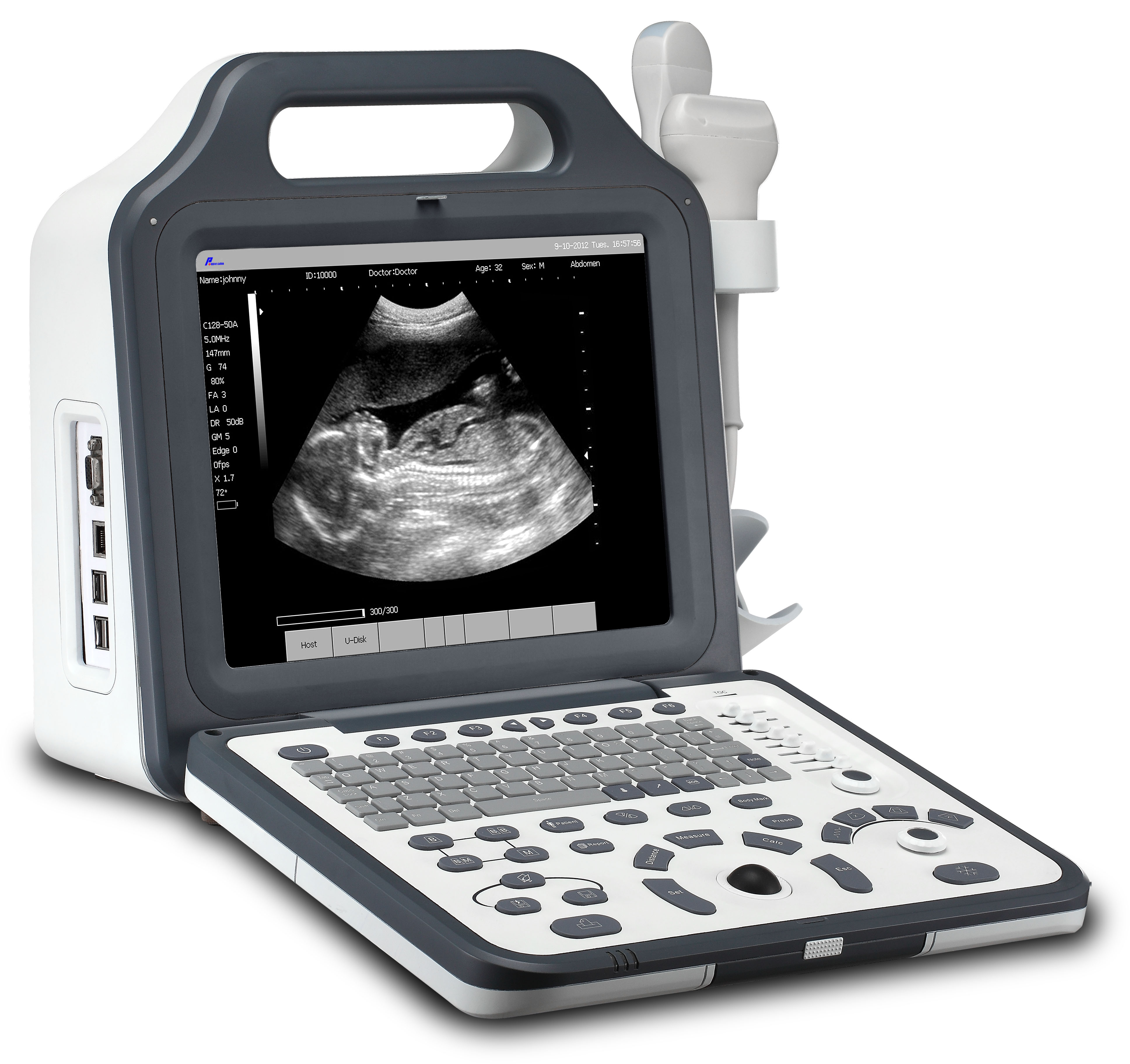 CE-genehmigtes Krankenhaus 12.1 "LCD-Digital-Laptop-Ultraschall (wwwc60p)