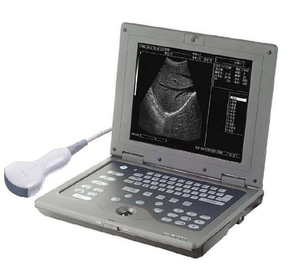 Medizinische Ultraschallinstrumente Laptop-Ultraschallgerät S/W Tragbarer digitaler Ultraschallscanner