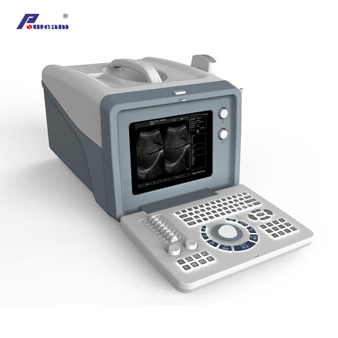 CE-genehmigtes Krankenhaus 12.1 "LCD Digital Laptop Ultraschall